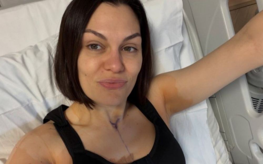 Džesi Džej vratila se na Instagram nakon druge operacije rekonstrukcije dojke